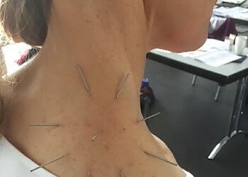 Akupunktur Berlin Kreuzberg Dagmar Amtmann image Akupunktur Berlin Kreuzberg Dagmar Amtmann