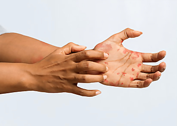 Dr. med. Khusru Asadullah - Dermatologie Potsdam Privatpraxis image Dr. med. Khusru Asadullah - Dermatologie Potsdam Privatpraxis