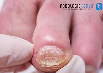 Podologie Berlin image Podologie Berlin
