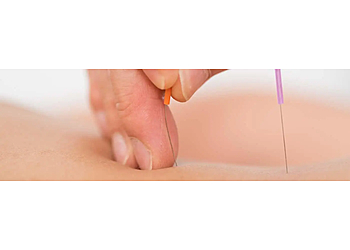 Praxis für Akupunktur, Traditionelle Chinesische Medizin photo Praxis für Akupunktur, Traditionelle Chinesische Medizin